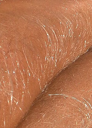 Hairy Arms